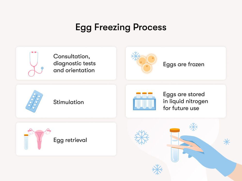 The egg freezing process includes medical consultation to assess ovarian reserve, blood tests, and pelvic ultrasound. Ovarian stimulation is carried out using injectable hormonal medications, followed by egg retrieval under sedation.