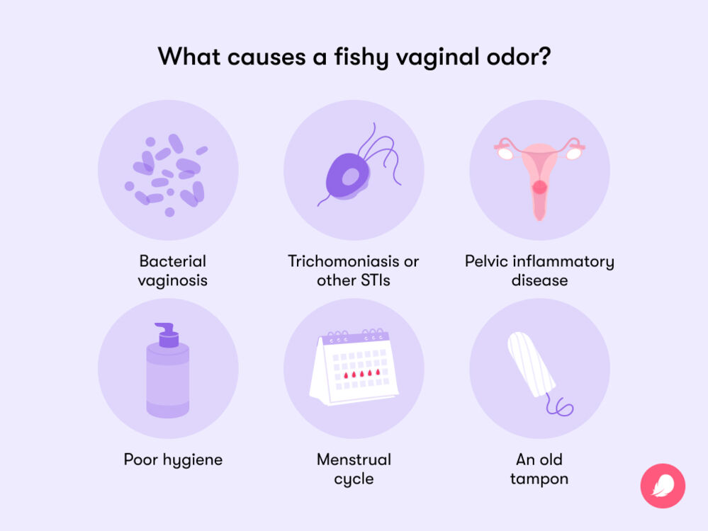 Common causes of a fishy vaginal odor may include poor hygiene, bacterial vaginosis, Trichomoniasis or other STIs, pelvic inflammatory disease, and hormonal fluctuations.