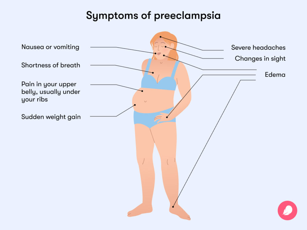 Symptoms of preeclampsia include nausea, shortness of breath, sudden weight gain, changes in sight, and severe headaches