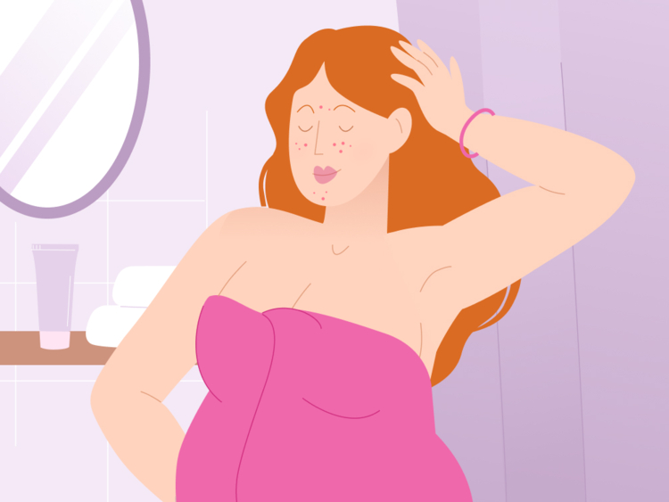 Pregnancy acne: How can you deal with it?