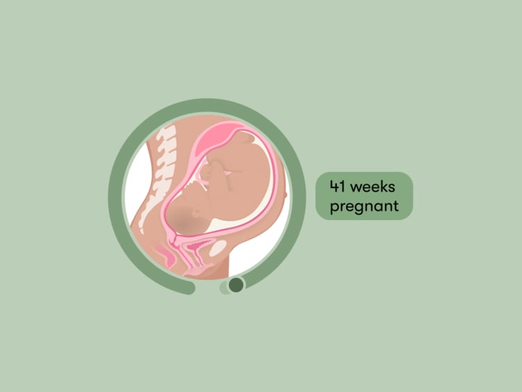 41 weeks pregnant: Your guide to this week of your third trimester