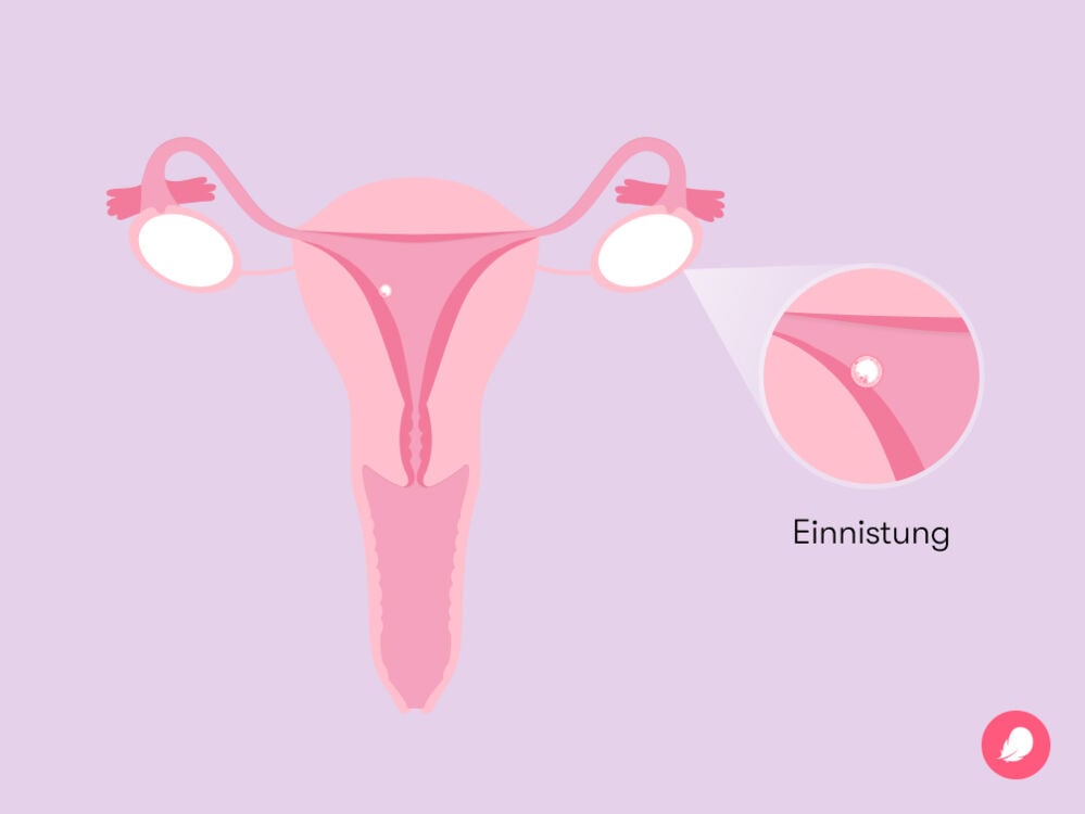 Single image Ein Embryo nistet sich in der Gebärmutterwand ein