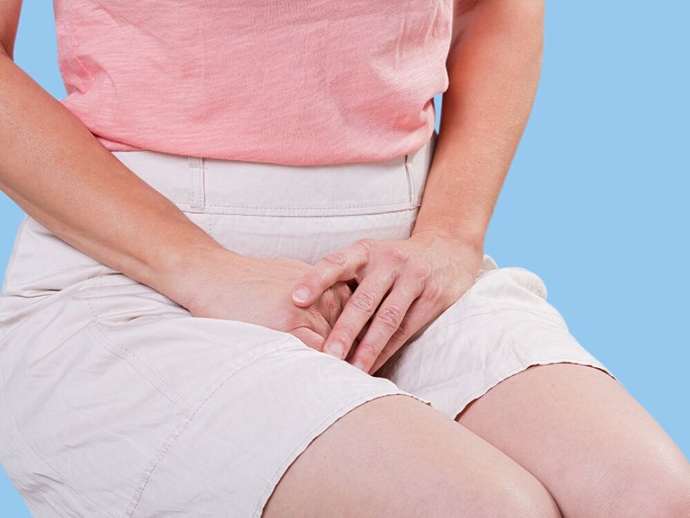 Woman after IUD expulsion Woman after IUD expulsion