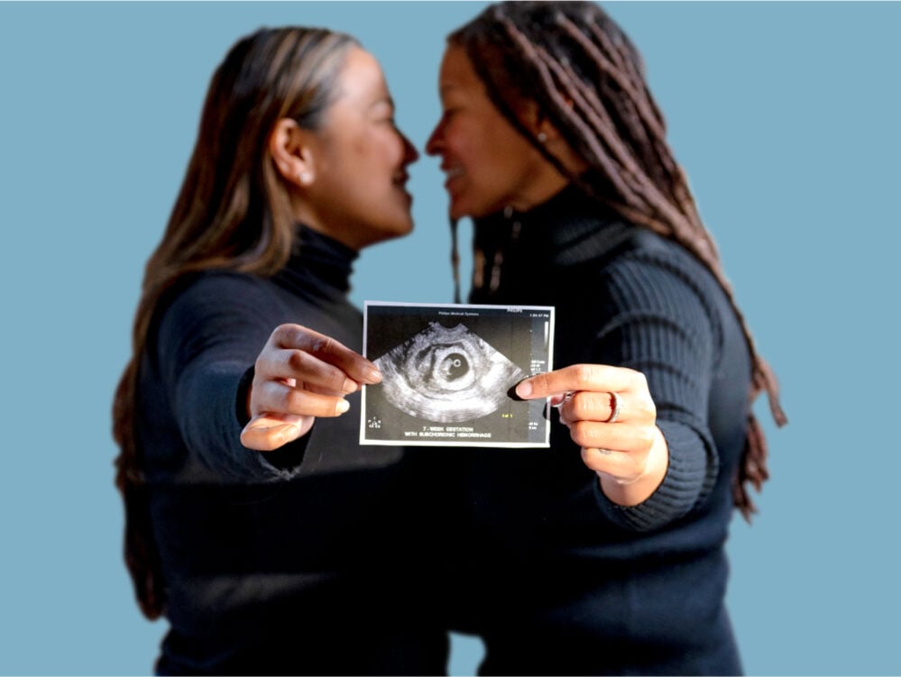 Single image Single image