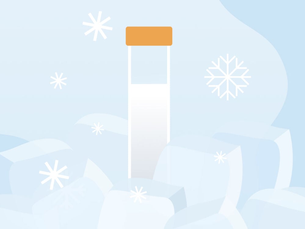 How much does it cost to freeze eggs? How much does it cost to freeze eggs?
