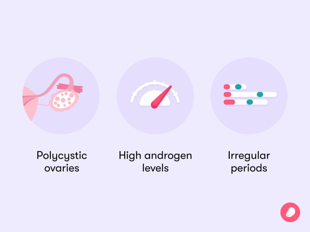 the signs of PCOS the signs of PCOS
