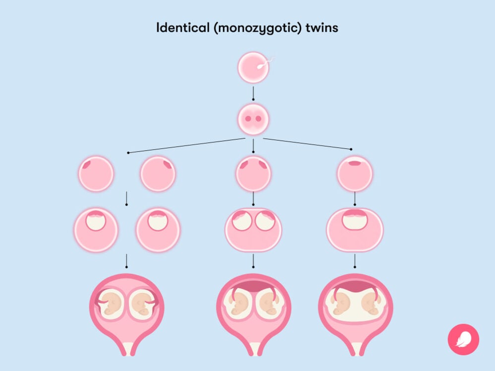 how an egg splits when you have identical twins how an egg splits when you have identical twins