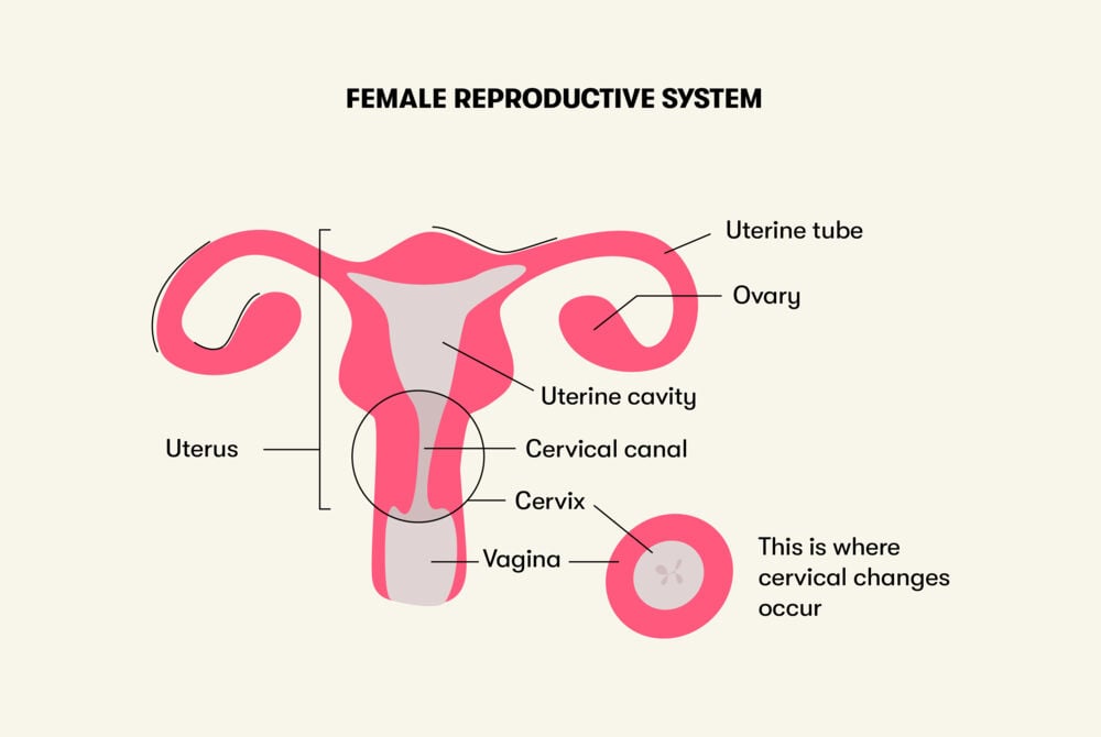 Female reproductive system Infographic illustrating the components of the female reproductive system, emphasizing the location of the cervix and areas where cervical conditions may arise.