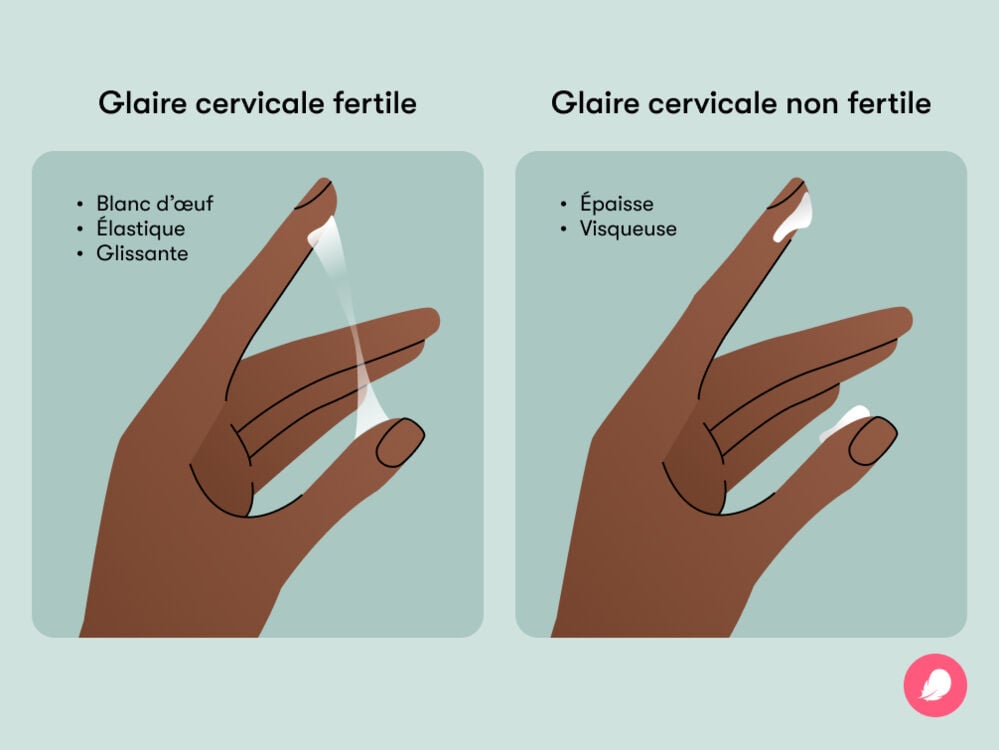 Image montrant la différence entre la glaire cervicale fertile et non fertile Image montrant la différence entre la glaire cervicale fertile et non fertile