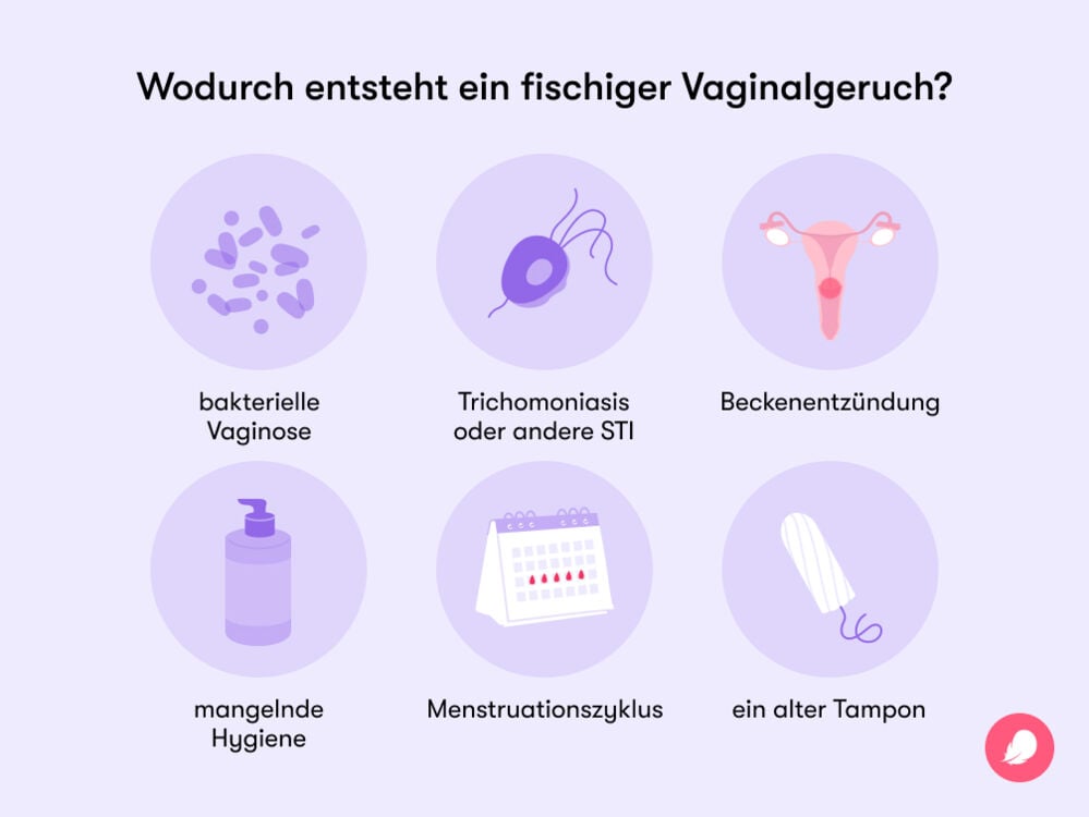 Single image Zu den häufigsten Ursachen eines fischigen Vaginalgeruchs gehören mangelnde Hygiene, bakterielle Vaginose, Trichomoniasis oder andere STI, Beckenentzündung und hormonelle Schwankungen.