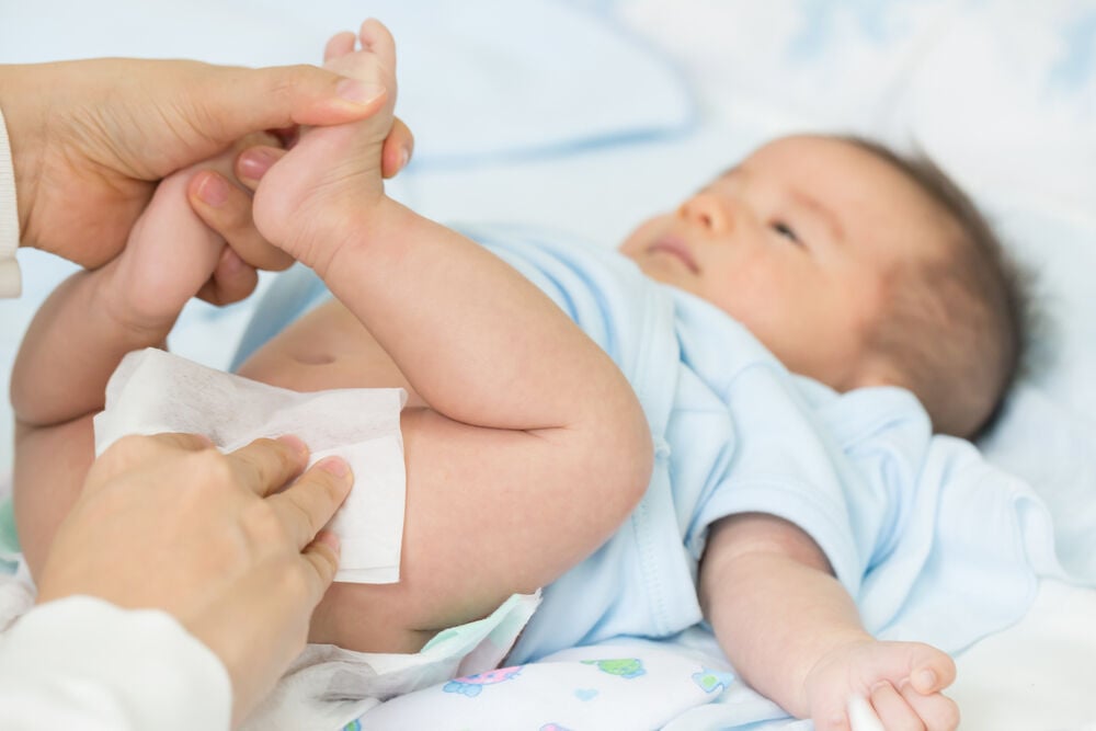 A circumcised newborn A circumcised newborn
