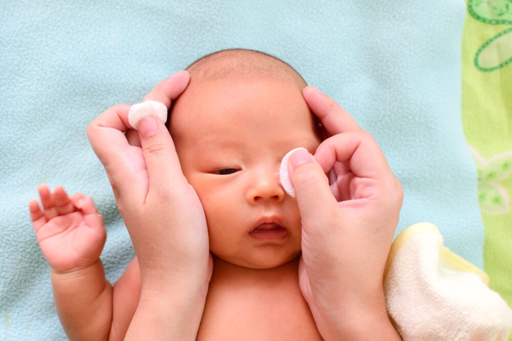 A mom applies warm compress to the baby's eyes A mom applies warm compress to the baby's eyes