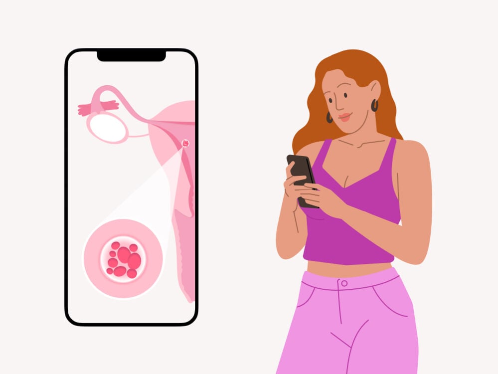 Single image Mulher olhando para um celular e a tela do aparelho ampliada com o desenho de um óvulo fecundado