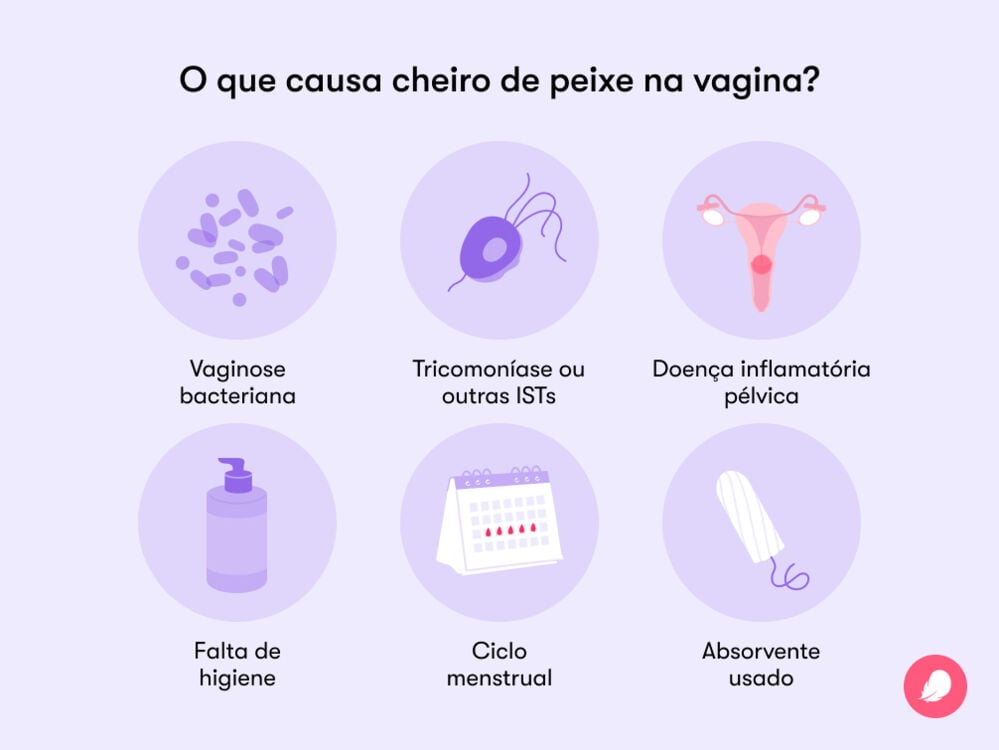 Single image Causas comuns de mal cheiro na vagina podem incluir má higiene, vaginose bacteriana, tricomoníase ou outras IST, doença inflamatória pélvica e oscilações hormonais.