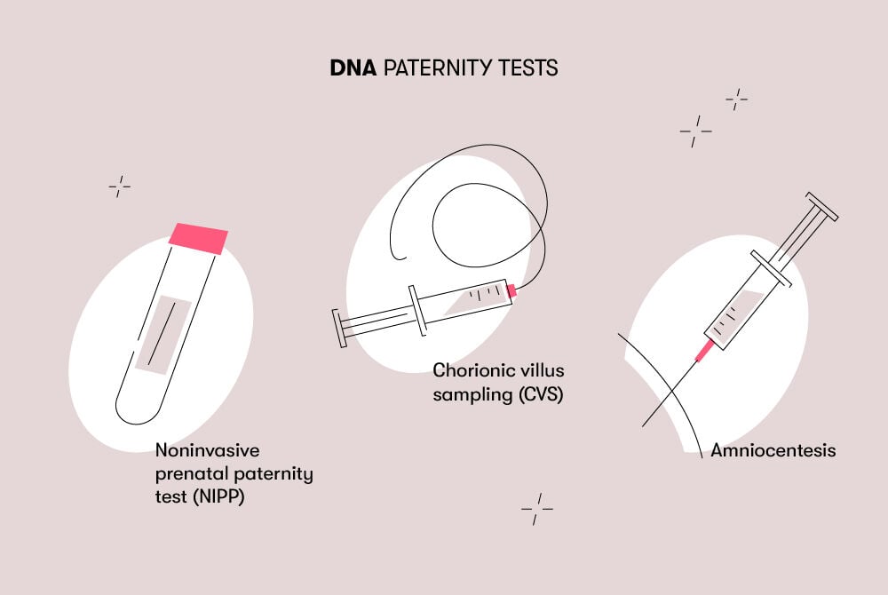 DNA paternity tests The three methods of paternity testing during pregnancy are non-invasive prenatal paternity test (NIPP), Chorionic villus sampling (CVS) and amniocentesis