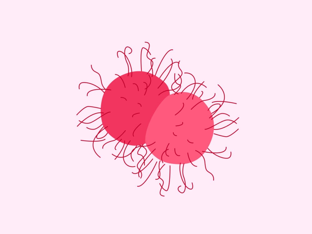 sti gonorrhea sti gonorrhea