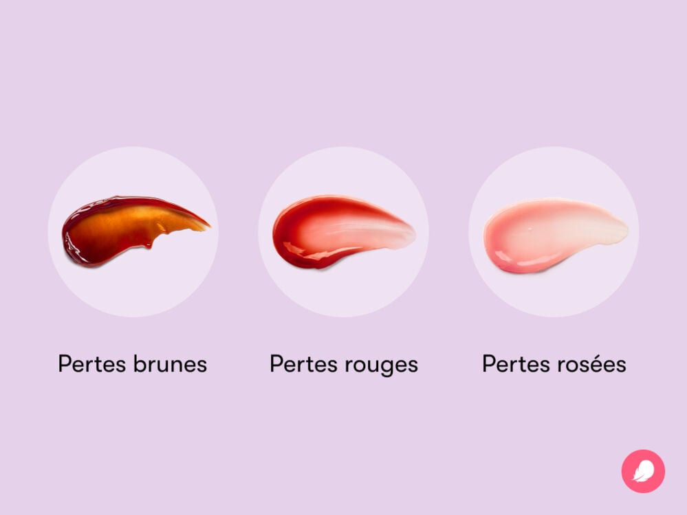 Single image Visuel montrant à quoi ressemblent les pertes brunes, les pertes rouges et les pertes roses et à quoi elles diffèrent les unes des autres