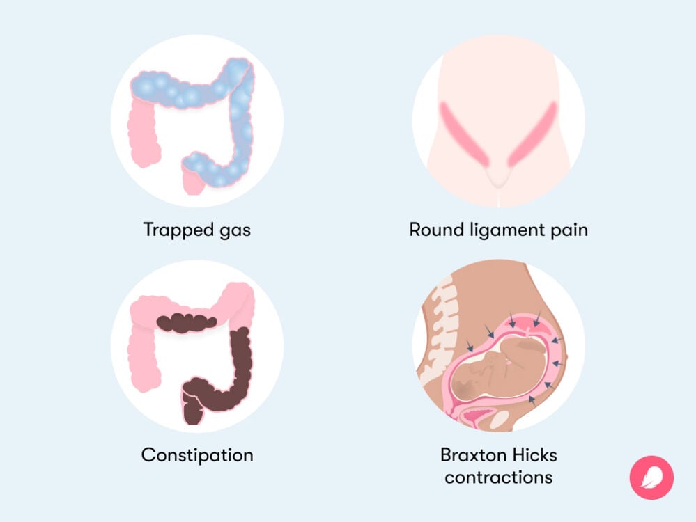 the different causes of cramping during pregnancy The causes of cramping during pregnancy include constipation, trapped gas, round ligament pain and Braxton Hicks contractions