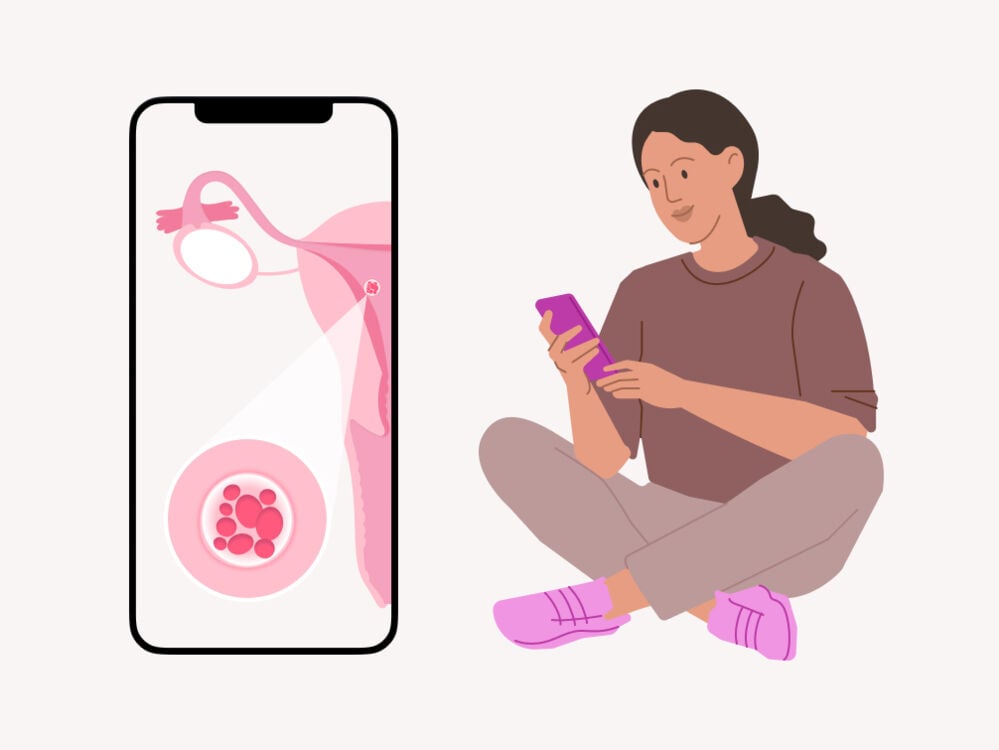 Single image Una mujer lee sobre la implantación en su teléfono