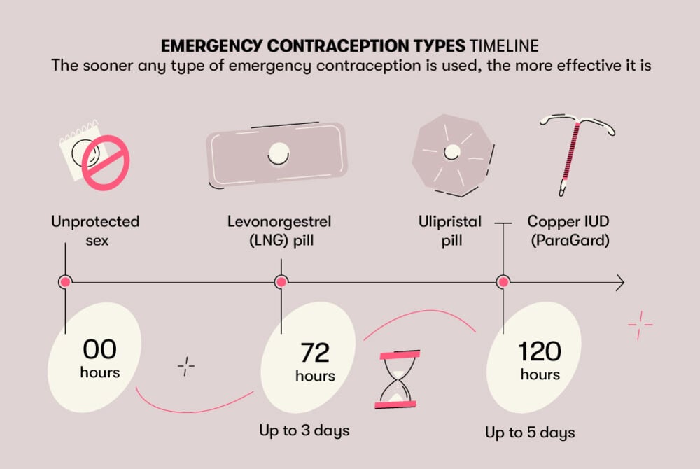 Emergency contraception types Levonorgestrel, a form of emergency contraception, can be effective up to three days after unprotected sex, while other methods such as ulipristal and a copper IUD can be effective up to day five