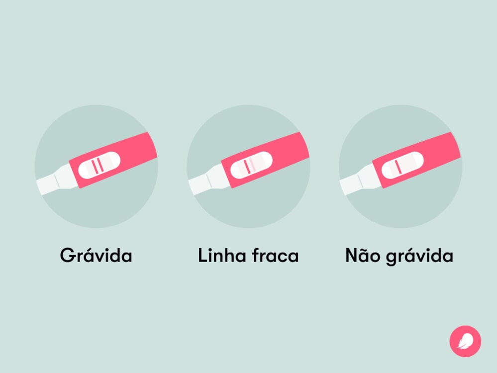 Ilustração de testes de gravidez com os três resultados: duas linhas (grávida), linha fraca e uma linha (não grávida) Ilustração de testes de gravidez com os três resultados: duas linhas (grávida), linha fraca e uma linha (não grávida)