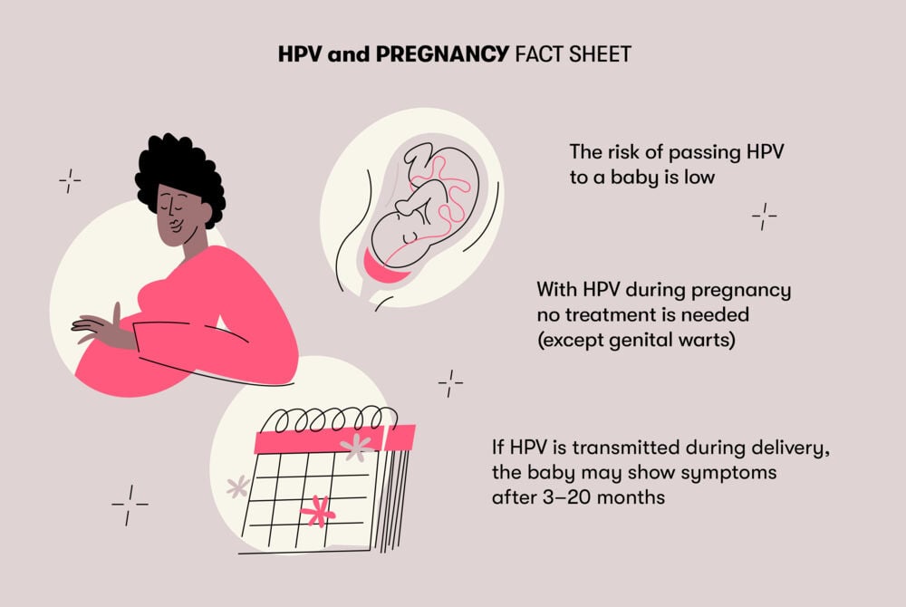 Hpv and pregnancy The chances of passing HPV to a baby during birth are low and there’s no treatment needed during pregnancy. If the baby does get infected, symptoms would show after 3-20 months