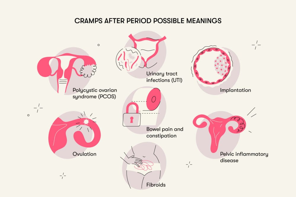 Cramps after period possible meanings Among the possible reasons some women might experience cramps outside of the menstruation stage are fibroids, pelvic inflammatory disease, implantation, UTIs, constipation, ovulation, or Polycystic Ovarian Syndrome.