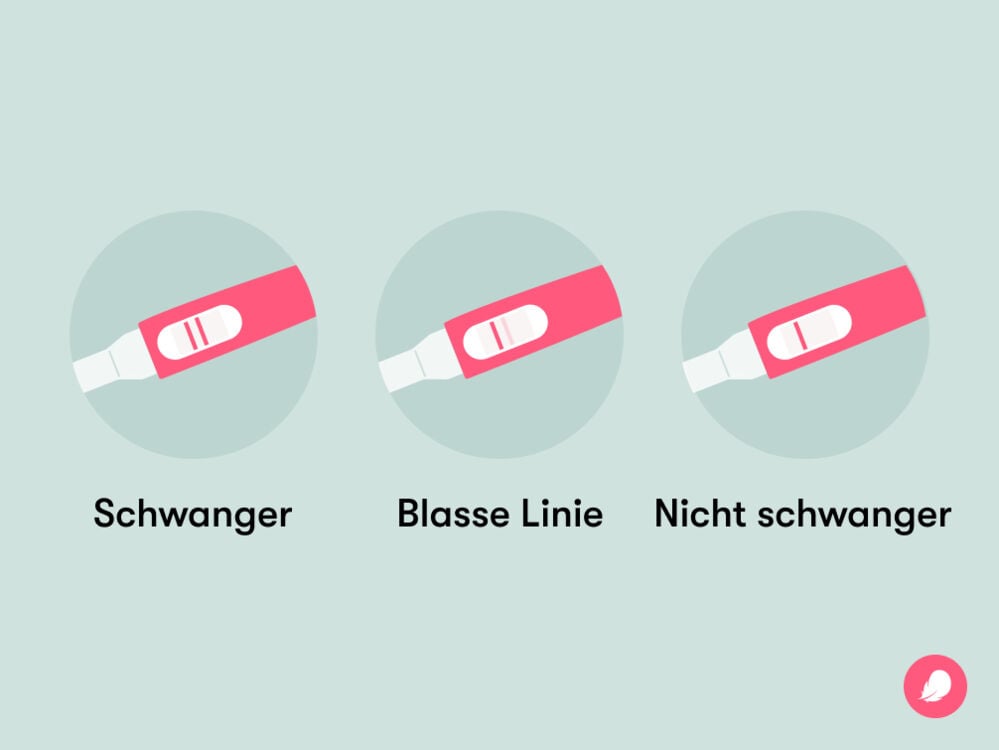 Single image Eine blasse Linie auf einem Schwangerschaftstest deutet auf einen niedrigen hCG-Spiegel hin und könnte aufgrund von verdünntem Urin, früher Schwangerschaft oder der Einnahme von hCG-haltigen Medikamenten auftreten.