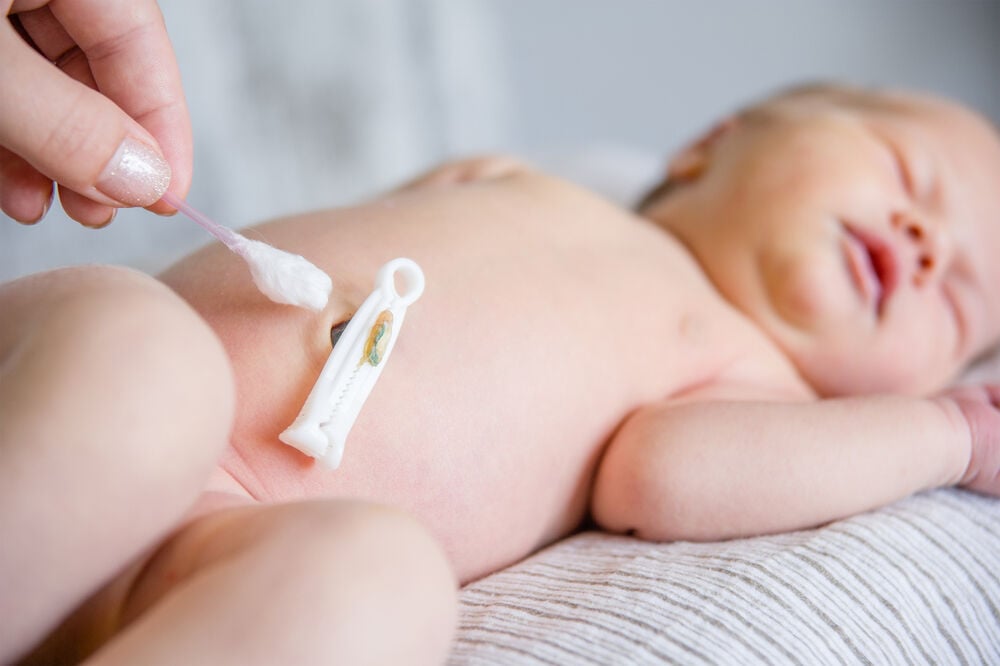 Umbilical cord care Umbilical cord care