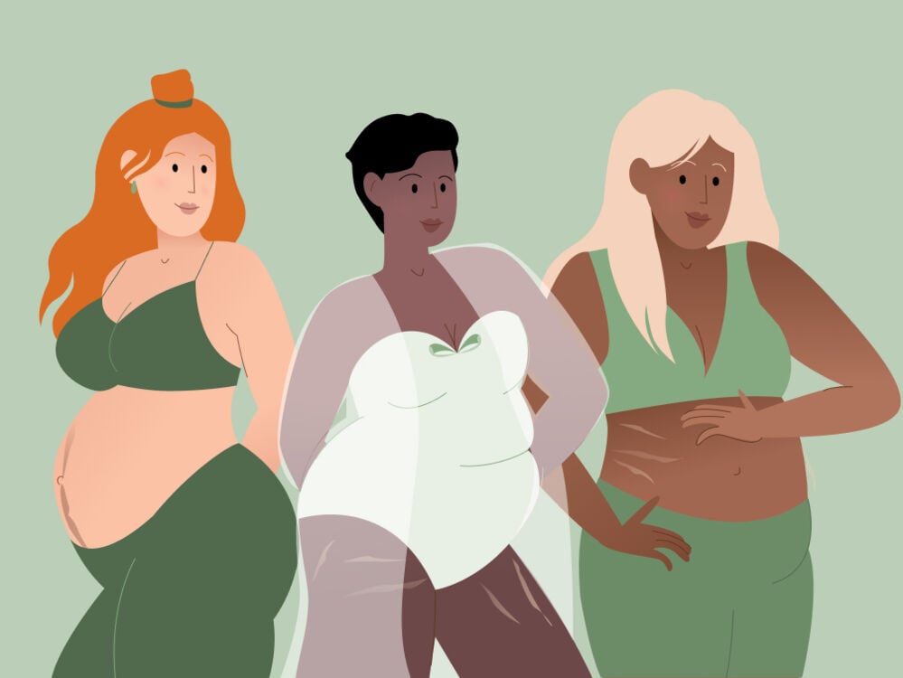 3 women with different pregnant belly shapes 3 women with different pregnant belly shapes
