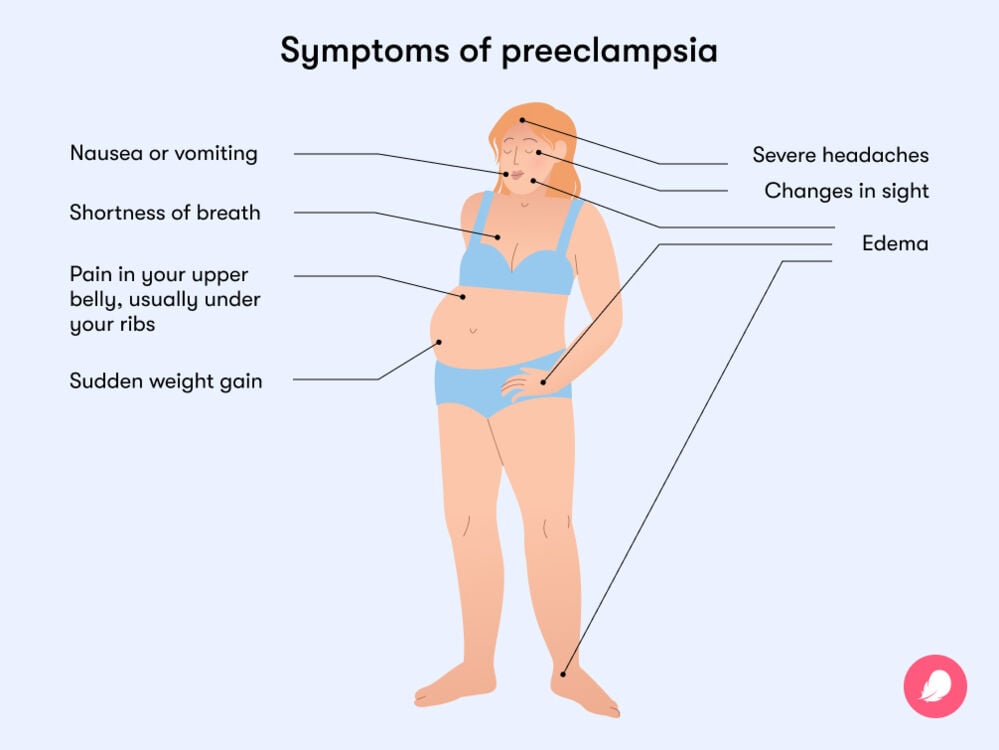Symptoms of preeclampsia Symptoms of preeclampsia include nausea, shortness of breath, sudden weight gain, changes in sight, and severe headaches
