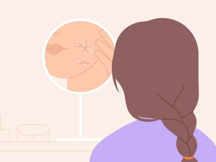 How to soothe dry skin caused by perimenopause How to soothe dry skin caused by perimenopause