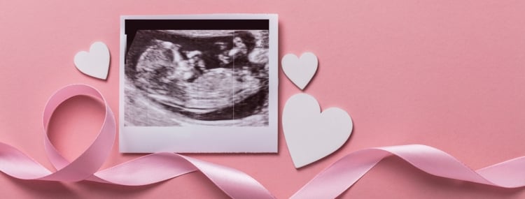 Fundal Placenta Position: Is a Placenta on Top a Problem? Fundal Placenta Position: Is a Placenta on Top a Problem?