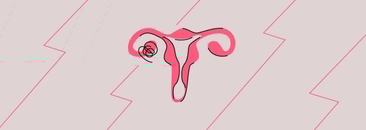 Pelvic Pain: What Does It Signal? Pelvic Pain: What Does It Signal?