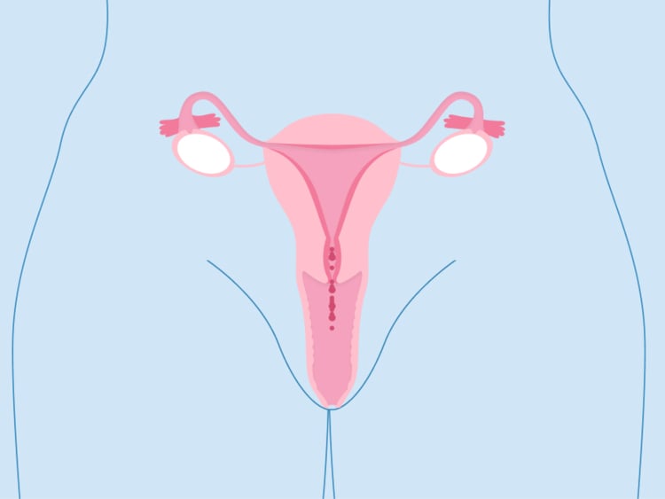Cervical cancer stages: Signs, treatments, and prevention Cervical cancer stages: Signs, treatments, and prevention
