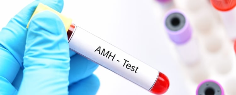 Prueba de la hormona antimulleriana: 6 cosas que debes saber