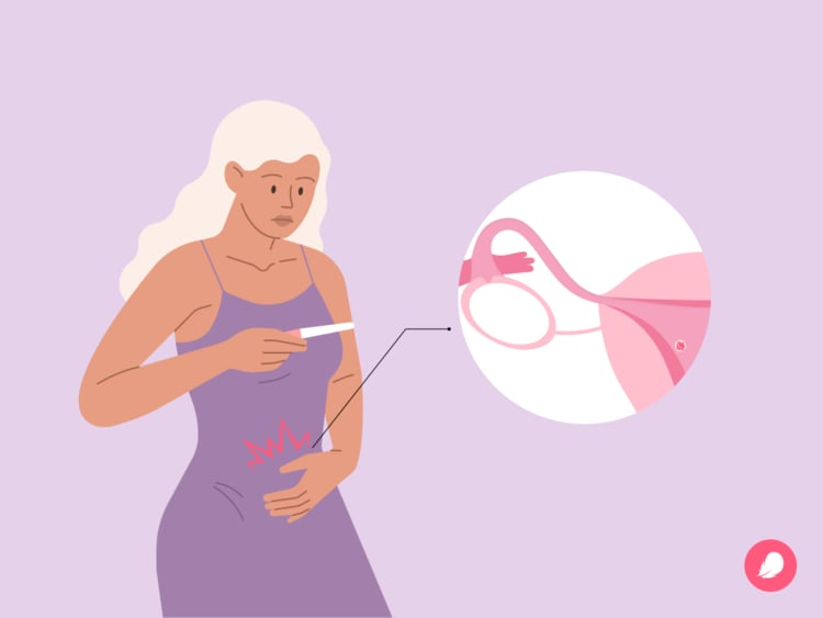 Implantation cramps: What they feel like and when they happen Implantation cramps: What they feel like and when they happen