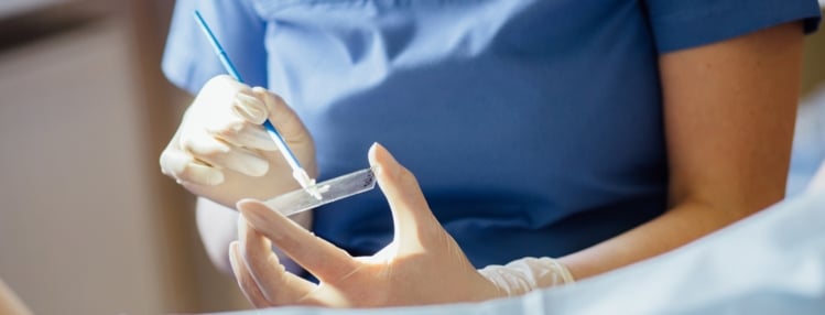 Can You Get a Pap Smear on Your Period? Can You Get a Pap Smear on Your Period?