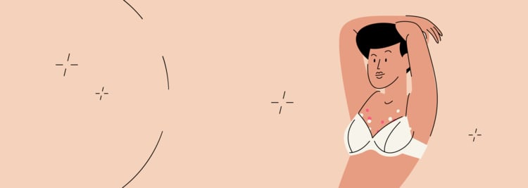 Yeast Infection Under Breasts and Nipple Thrush: Symptoms and Treatment Yeast Infection Under Breasts and Nipple Thrush: Symptoms and Treatment