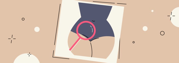 Adnexal Mass: Top Things to Know Adnexal Mass: Top Things to Know