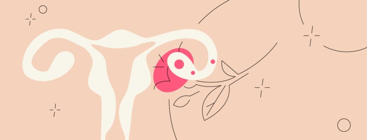 What Is Hyperovulation? How a Multiple Pregnancy Happens Naturally What Is Hyperovulation? How a Multiple Pregnancy Happens Naturally