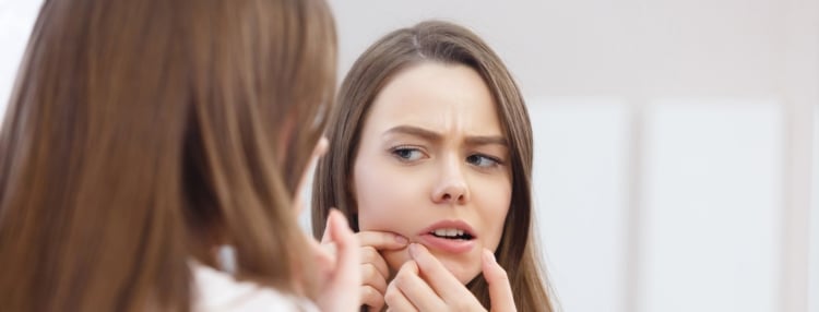 Acné: todo lo que debes saber Acné: todo lo que debes saber