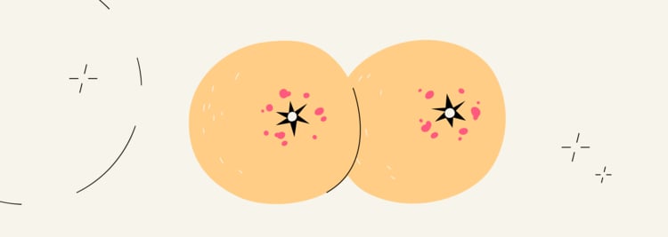 Inflammatory Breast Cancer: How to Spot It and What to Do About It Inflammatory Breast Cancer: How to Spot It and What to Do About It