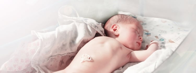 Umbilical Hernia: Definition, Symptoms, and Treatment Umbilical Hernia: Definition, Symptoms, and Treatment