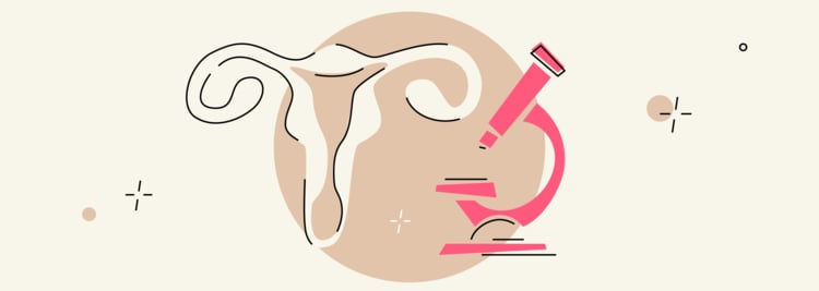 Colposcopy: What to Expect from a Colposcopy Procedure Colposcopy: What to Expect from a Colposcopy Procedure