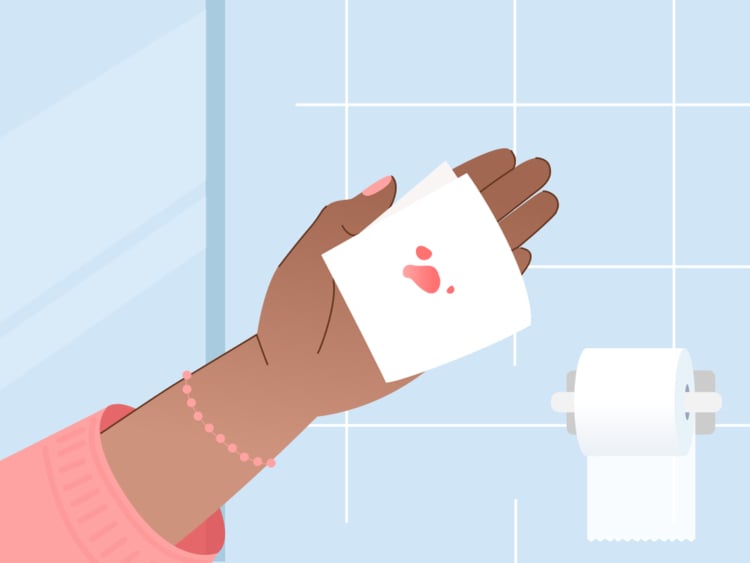 Implantation bleeding vs. period bleeding: How can you spot the difference? Implantation bleeding vs. period bleeding: How can you spot the difference?