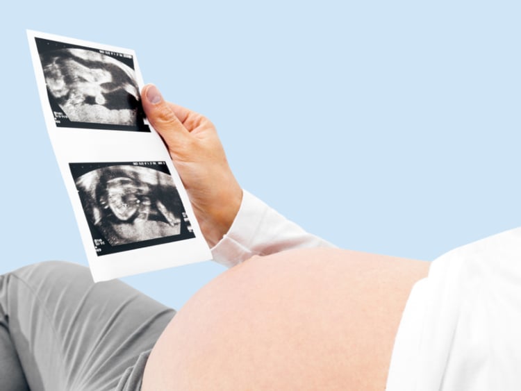 How to get pregnant with twins: Myths surrounding twin conception How to get pregnant with twins: Myths surrounding twin conception