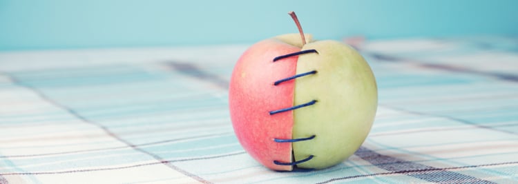 How to Care for Your Stitches After an Episiotomy to Minimize the Risk of Infection How to Care for Your Stitches After an Episiotomy to Minimize the Risk of Infection