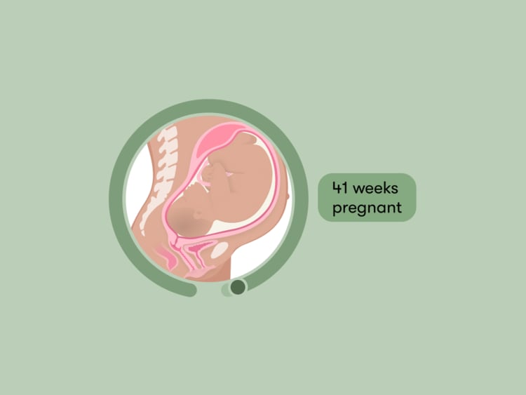 41 weeks pregnant: Your guide to this week of your third trimester 41 weeks pregnant: Your guide to this week of your third trimester
