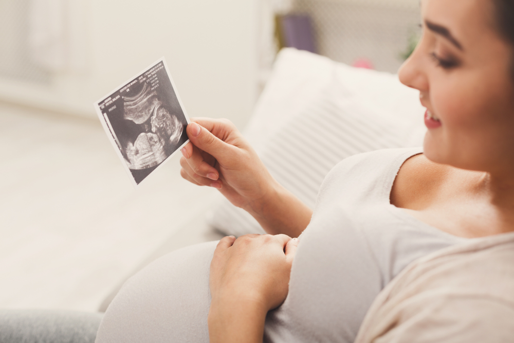 A pregnant woman having a posterior placenta looking at the ultrasound image of her baby A pregnant woman having a posterior placenta looking at the ultrasound image of her baby